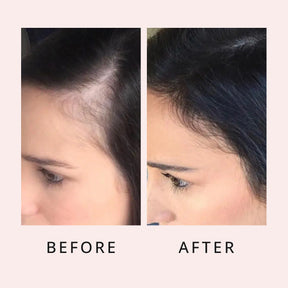 luxe hair growth serum before and after