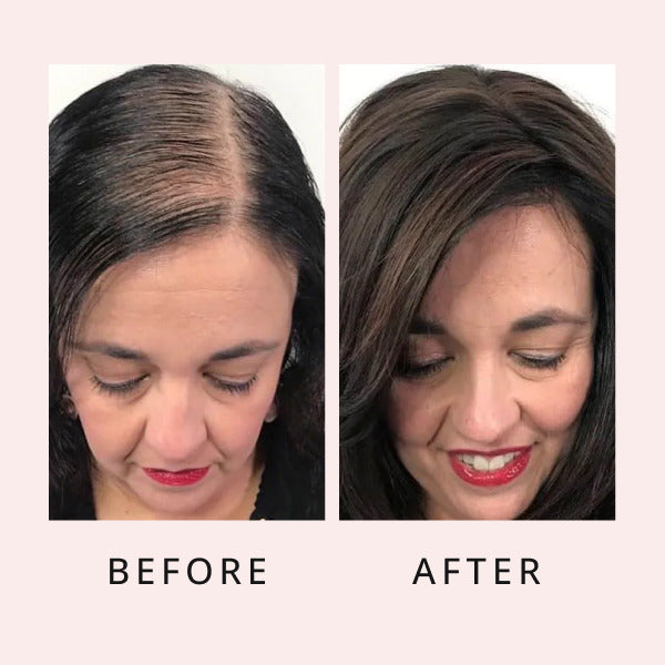 luxe hair growth serum before and after